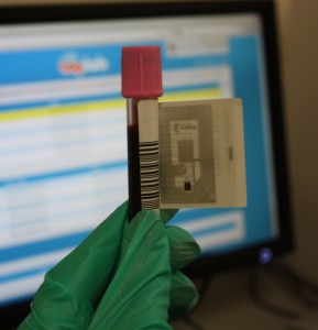 Tag RFID sulla provetta USLL 10 Veneto Orientale Provetta di materiale biologico dotata di tag RFID